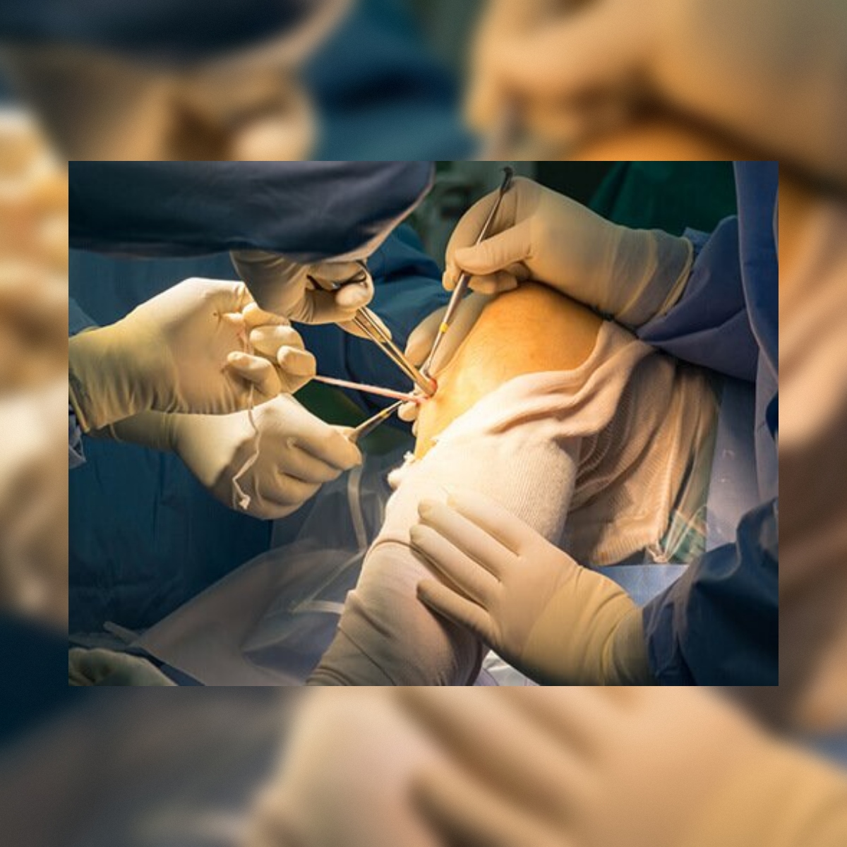 Chirurgie ambulatoire