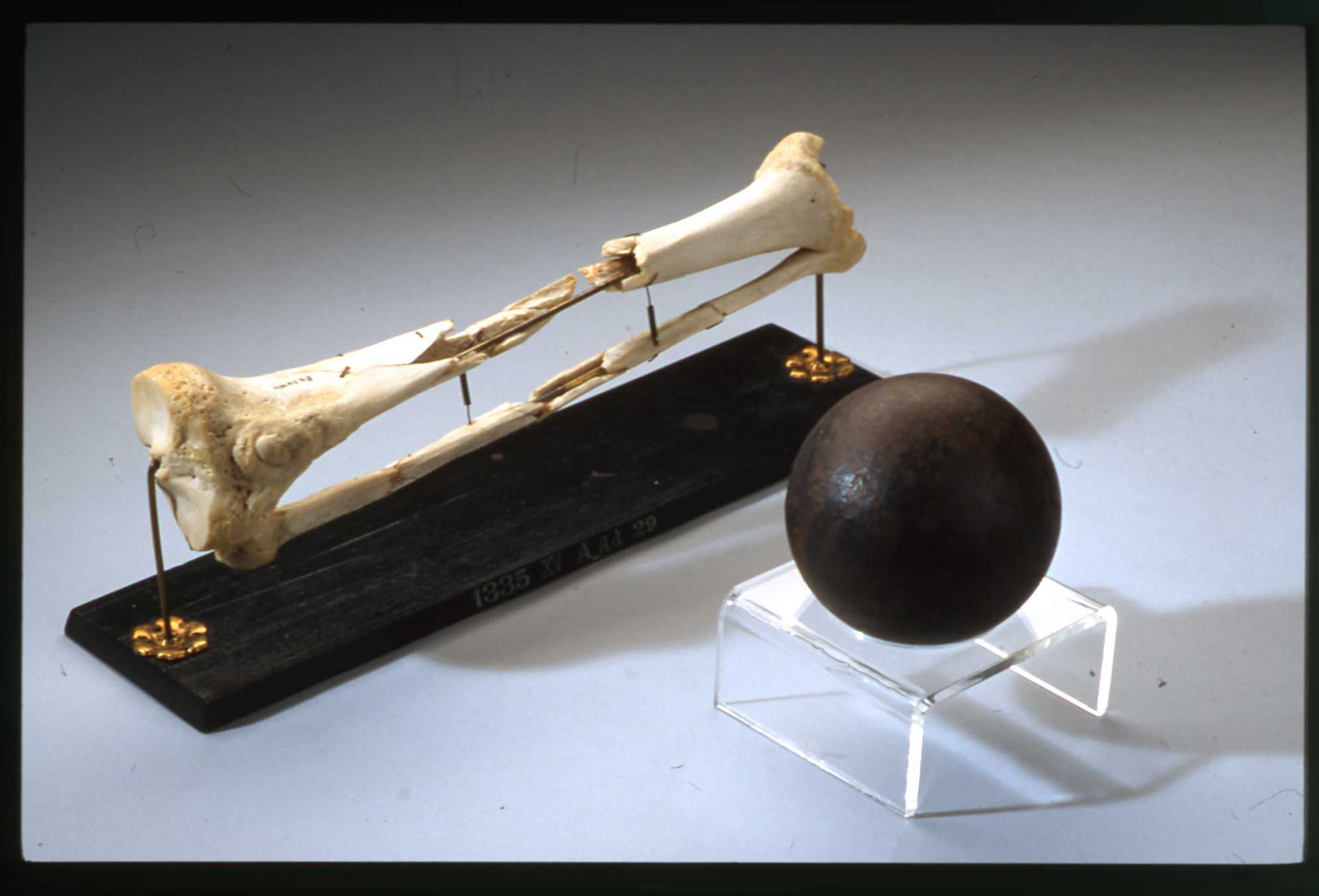 Chirurgie Traumatologique - Orthopédique et Traumatologique